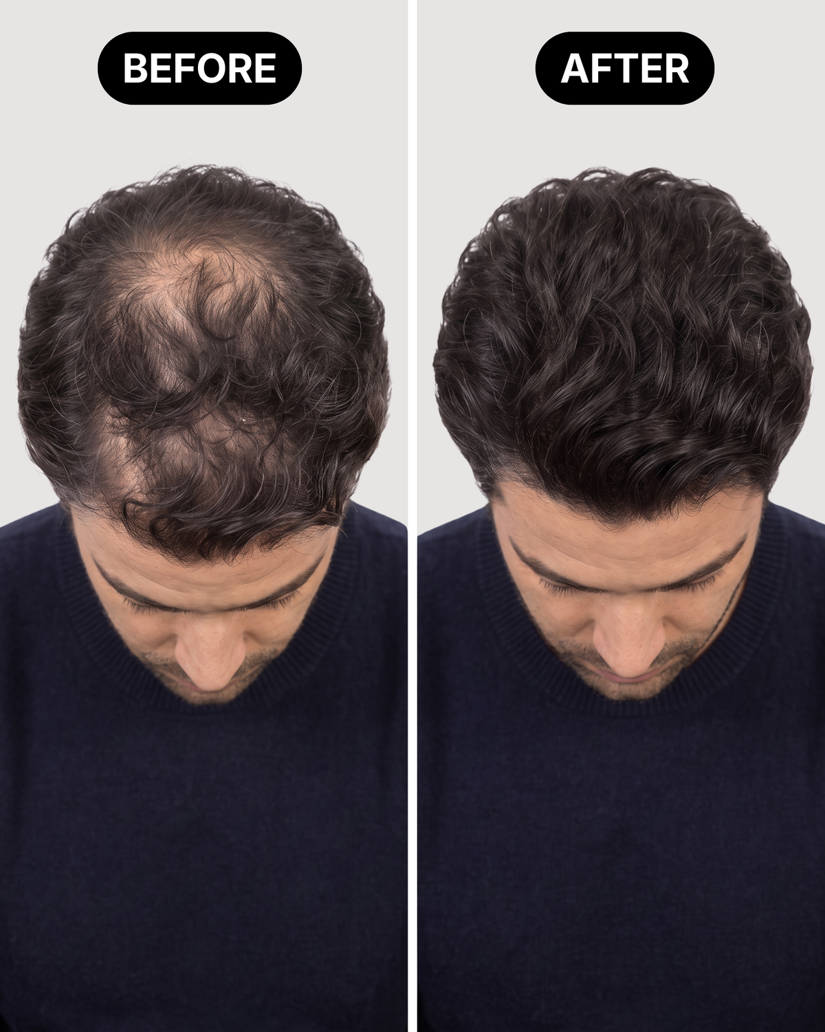 FULLHED Hair Fibers