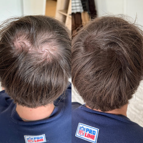 Thinning happens. Hiding it shouldn't be hard.