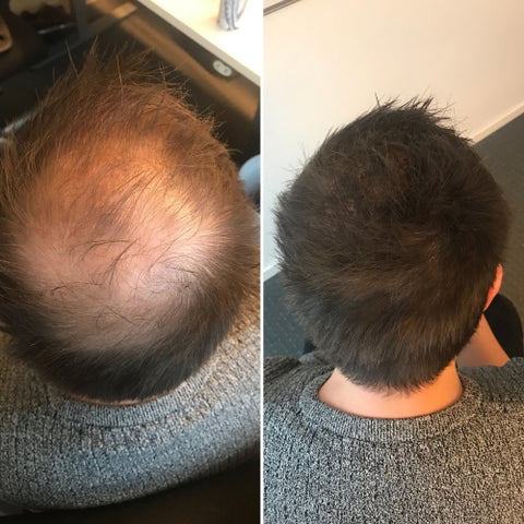 James R. with FULLHED